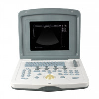 Ultrasound Machine 